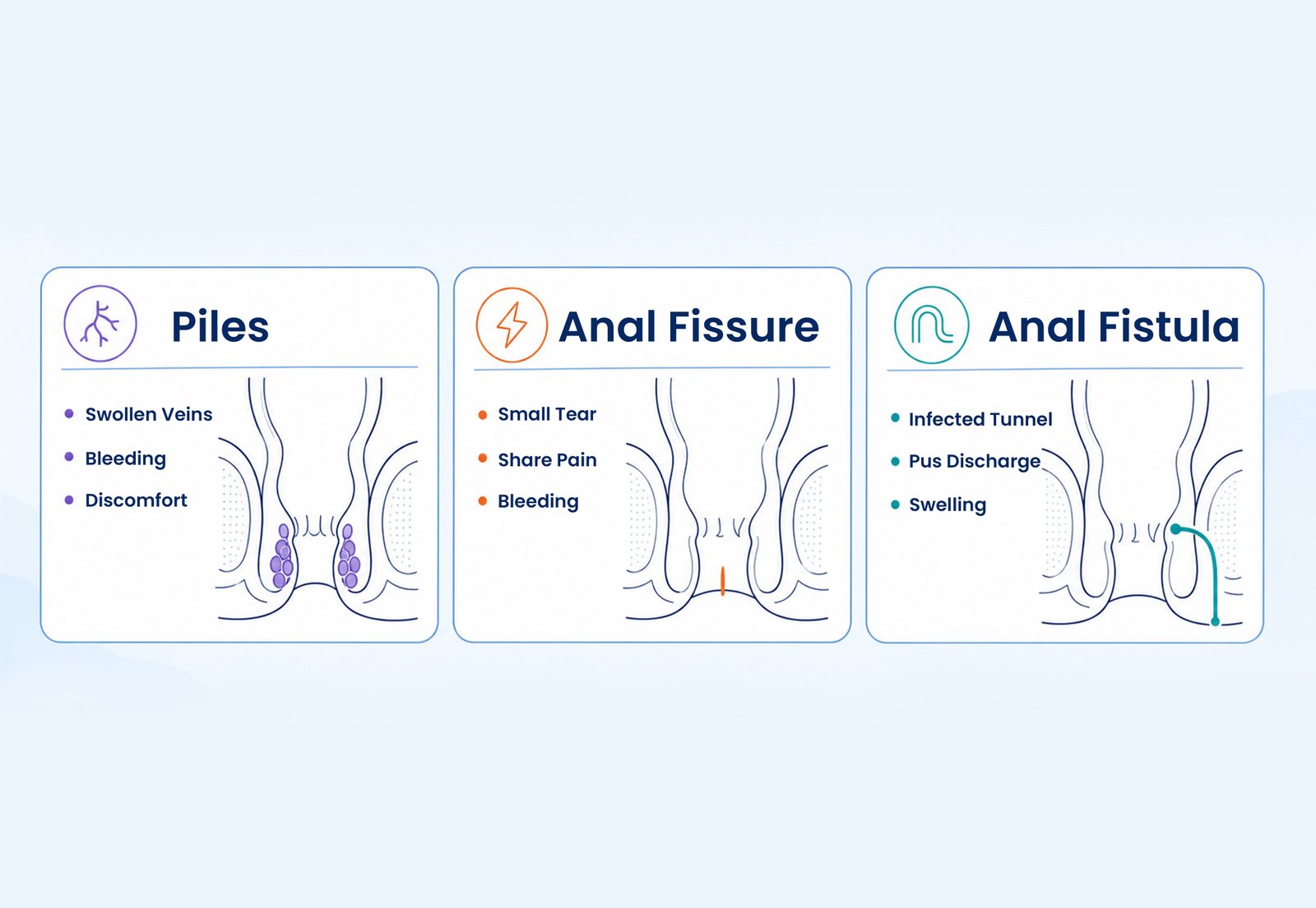 Comparison of piles, fissure and fistula symptoms and treatment options.